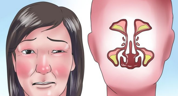8 Petua Hilangkan Hidung Tersumbat Dan Meredakan Resdung Dengan Berkesan Rahsia Rumahtangga